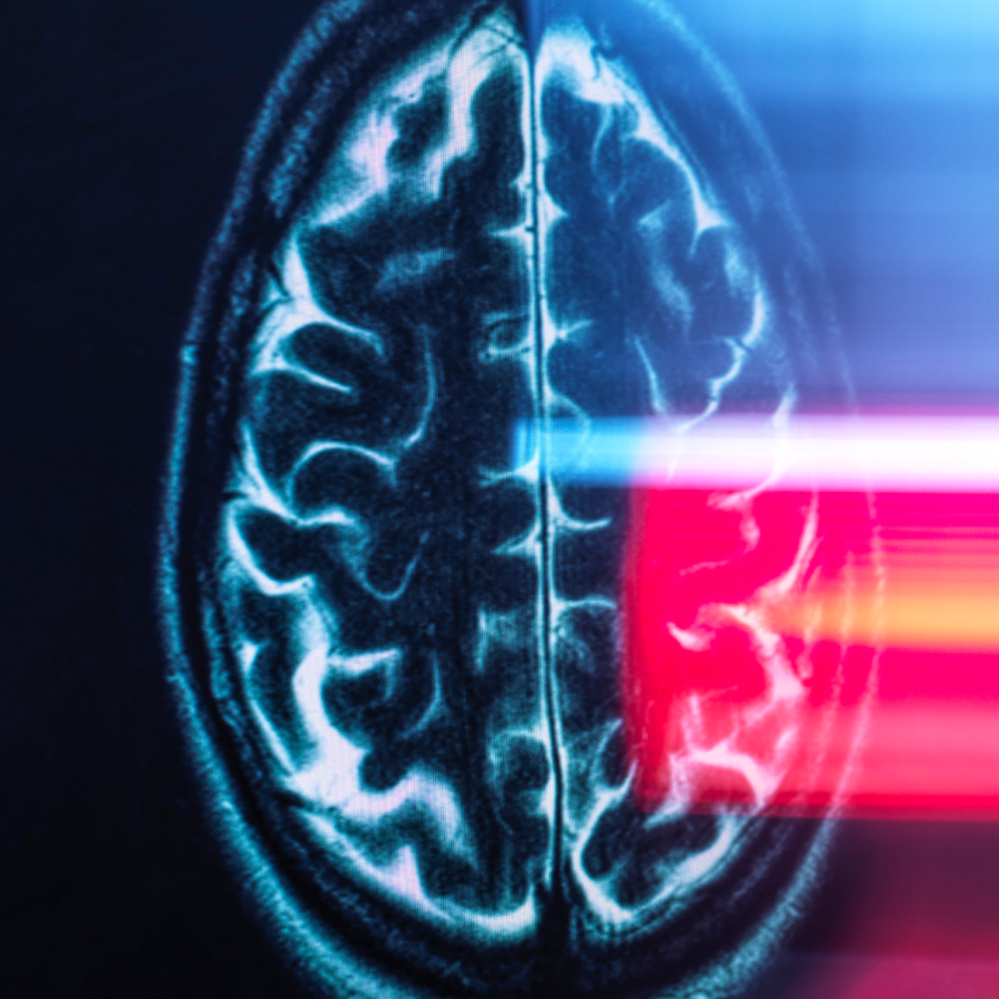 Brain Scans Reveal dial That Helps Keep Us From Getting Lost Live Science